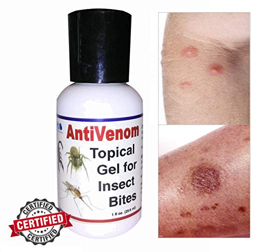 Anti-Venom ALKAVITA Gel 1